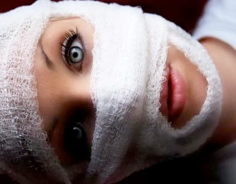 Cirug&iacute;a est&eacute;tica en adolescentes