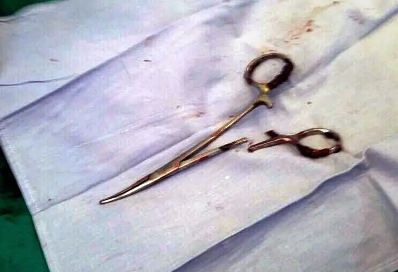 Tijeras en est&oacute;mago