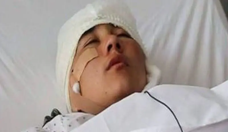 Le cortaron las orejas