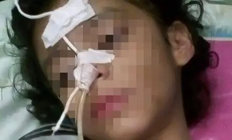 Ni&ntilde;a golpeada por su madrastra