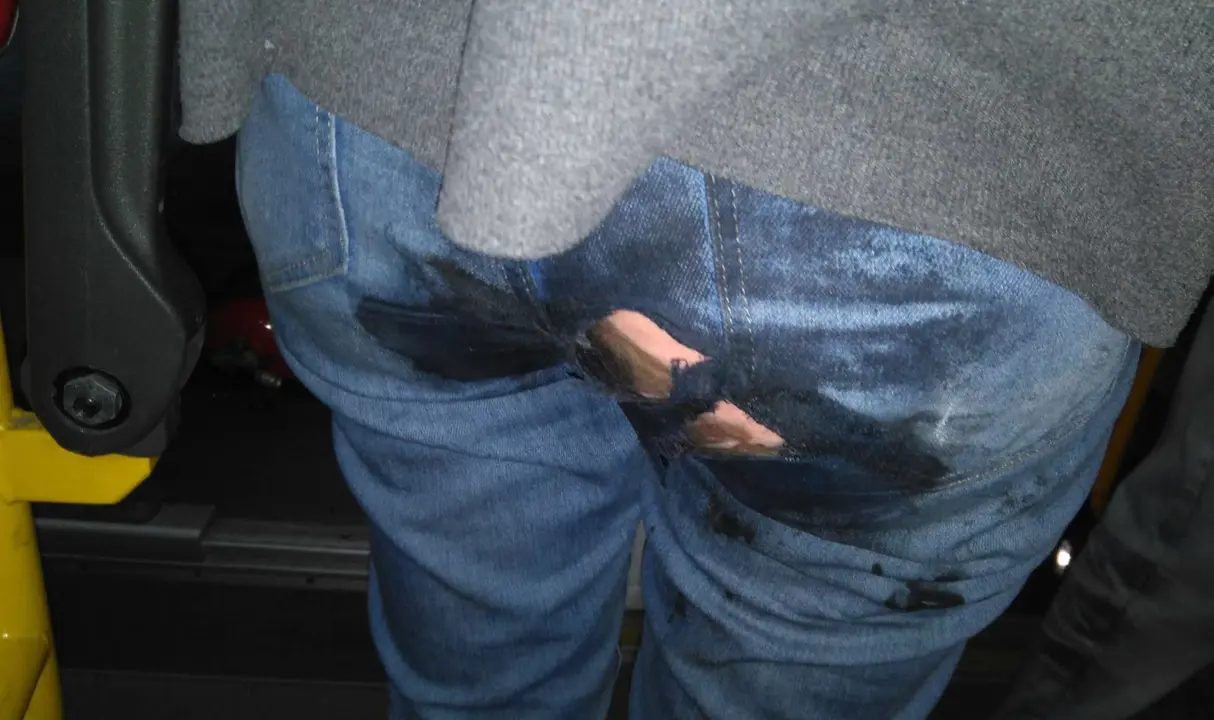 J&oacute;venes quemados