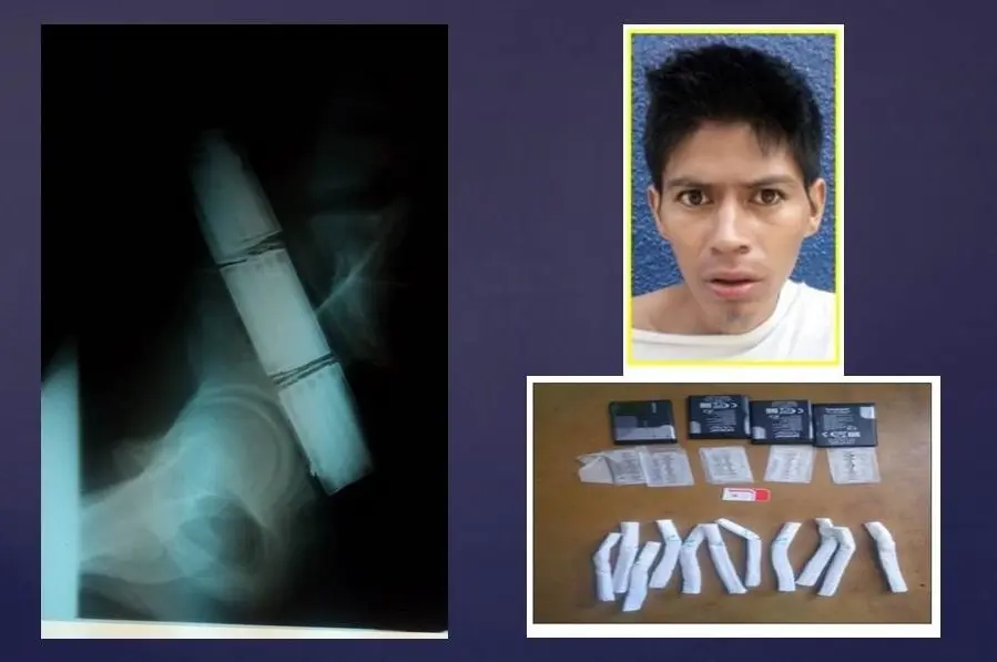 pandillero en mejicanos muere 18R