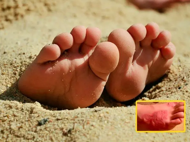 Noticia-211440-playa-ataque