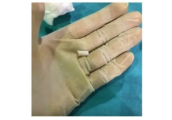 Imagen de referencia tomada de Notim&eacute;rica