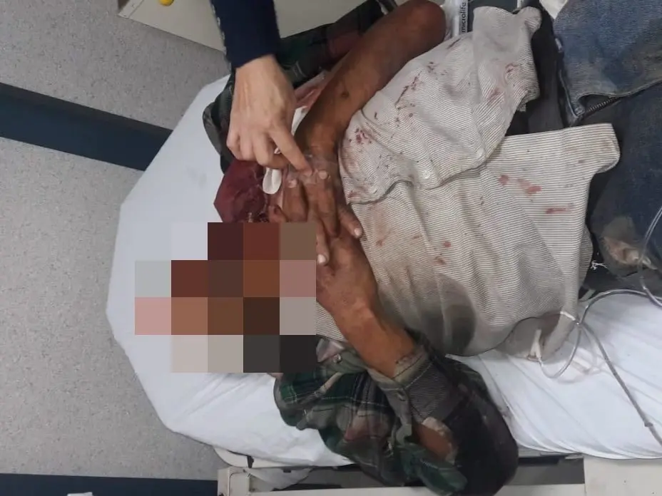 salvadore&ntilde;o golpeado