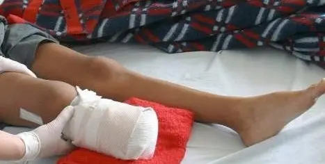 Imagen de referencia tomada de HSB Noticias