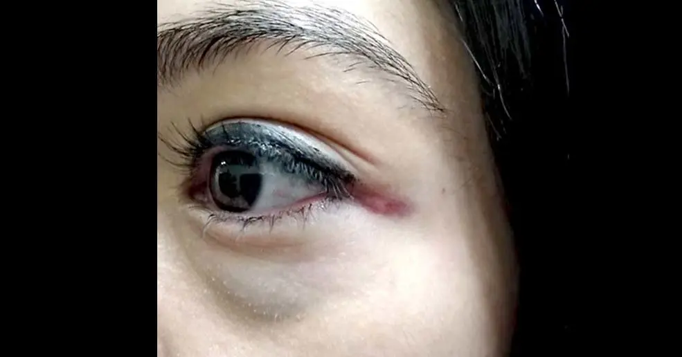 M&eacute;dico agredida