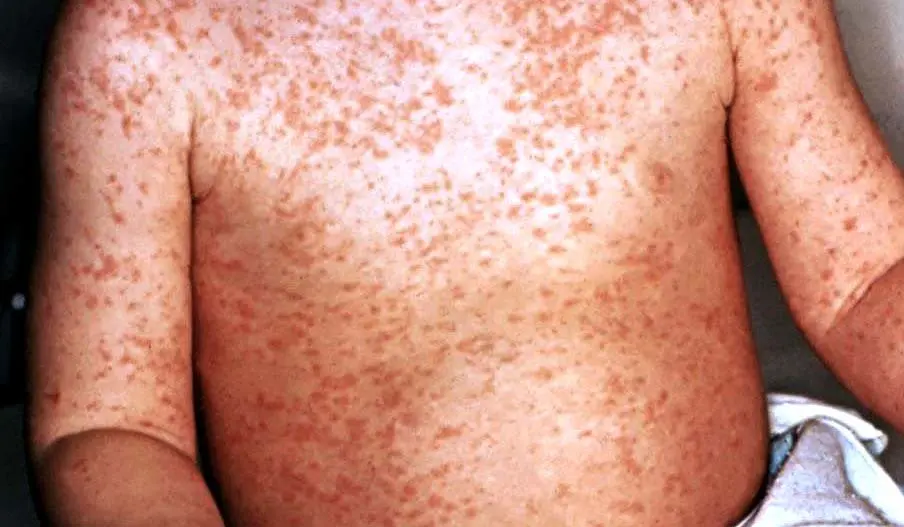 Direcci&oacute;n de vigilancia sanitaria 3