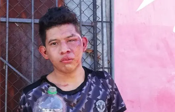 Ladr&oacute;n golpeado en Ciudad Delgado