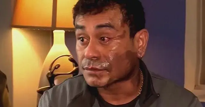 Hombre al que le lanzaron &aacute;cido en la cara