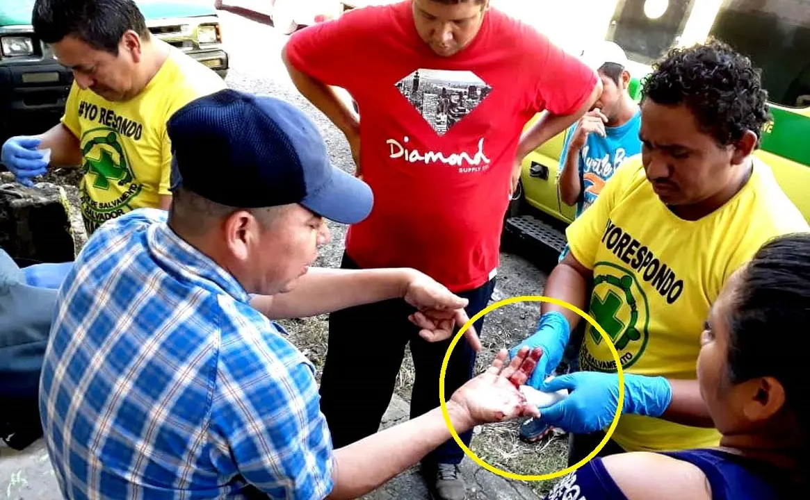 Na&uacute;n C&aacute;rcamo atacado por un perro chow chow en Ciudad Delgado 2