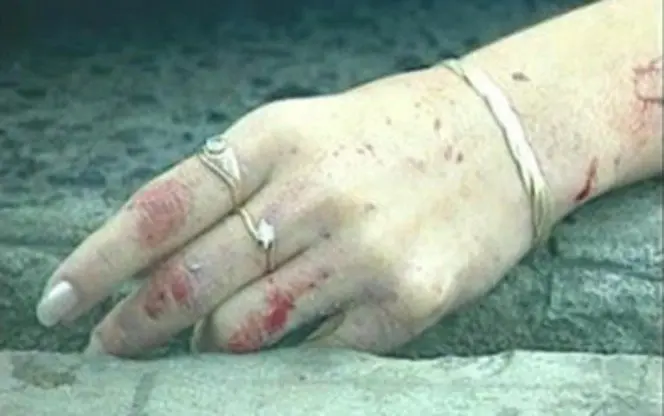Mano de mujer asesinada