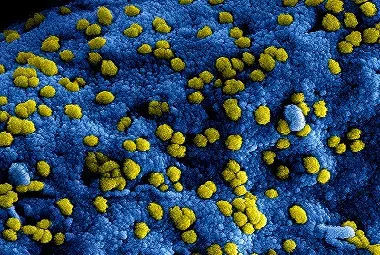 microscopic-shot-of-a-virus-3992937