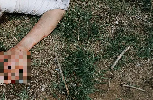 Cad&aacute;ver pixabay