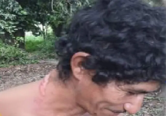 Intent&oacute; ahorcarse y ladr&oacute; le rob&oacute; el lazo