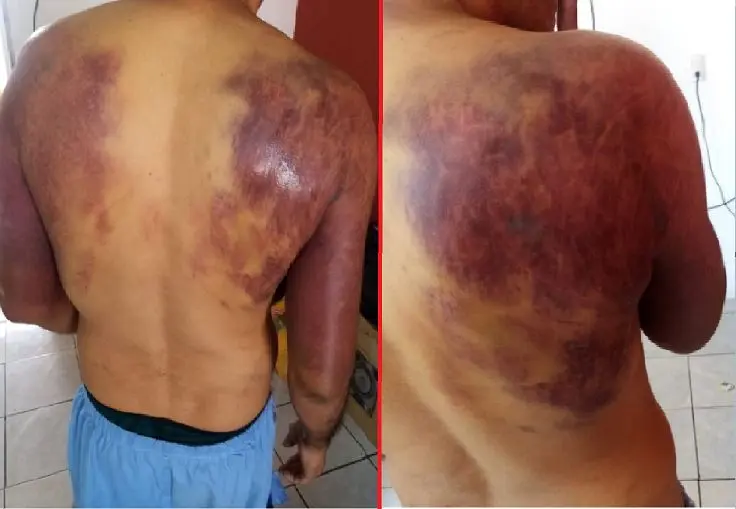 Trabajador recibe golpiza