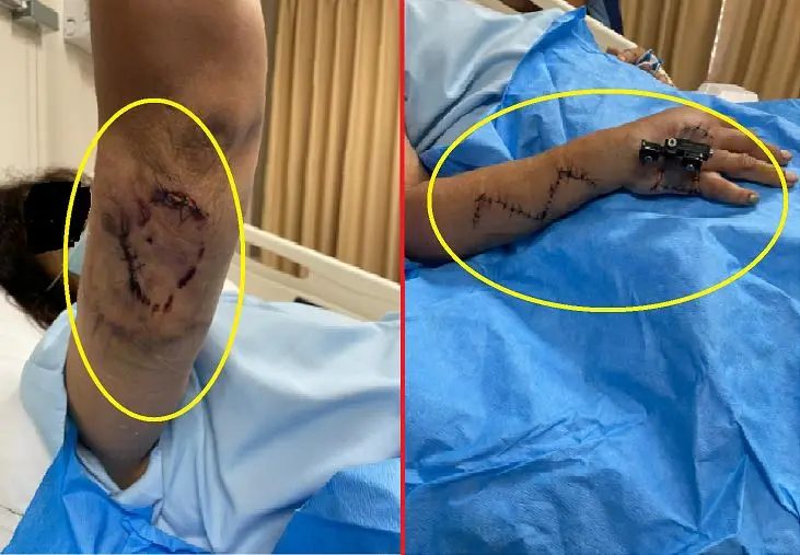 Mujer de 71 a&ntilde;os