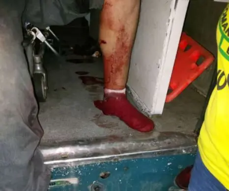 Baleado en pierna izquierda