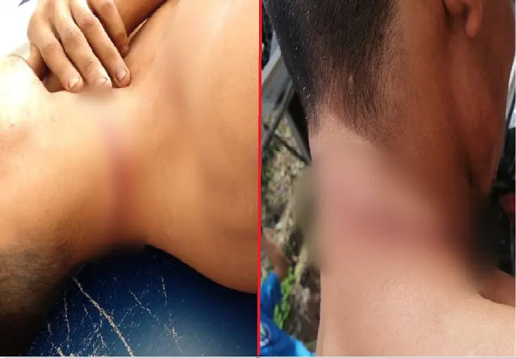 Se pretend&iacute;a ahorcar