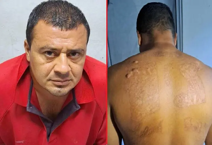 Supuesto pandillero intent&oacute; borrarse tatuajes