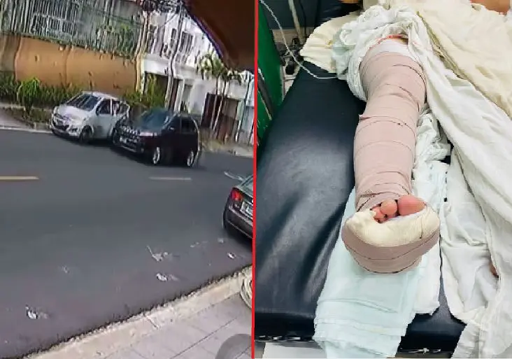 Quebradura en pierna derecha