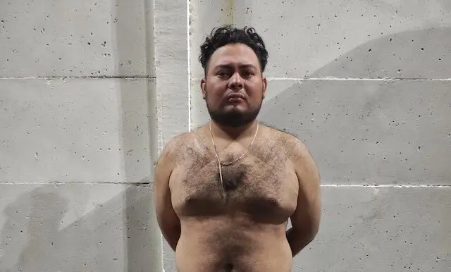 Osvaldo Vladimir López Méndez, 29 años de edad, lesiones