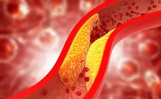 Colesterol en la sangre