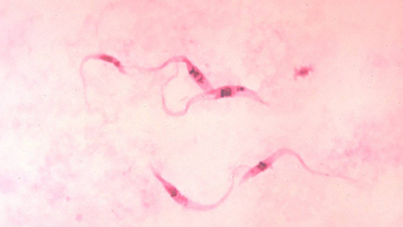 Flagelos de Trypanosoma cruzi bajo el microscopio