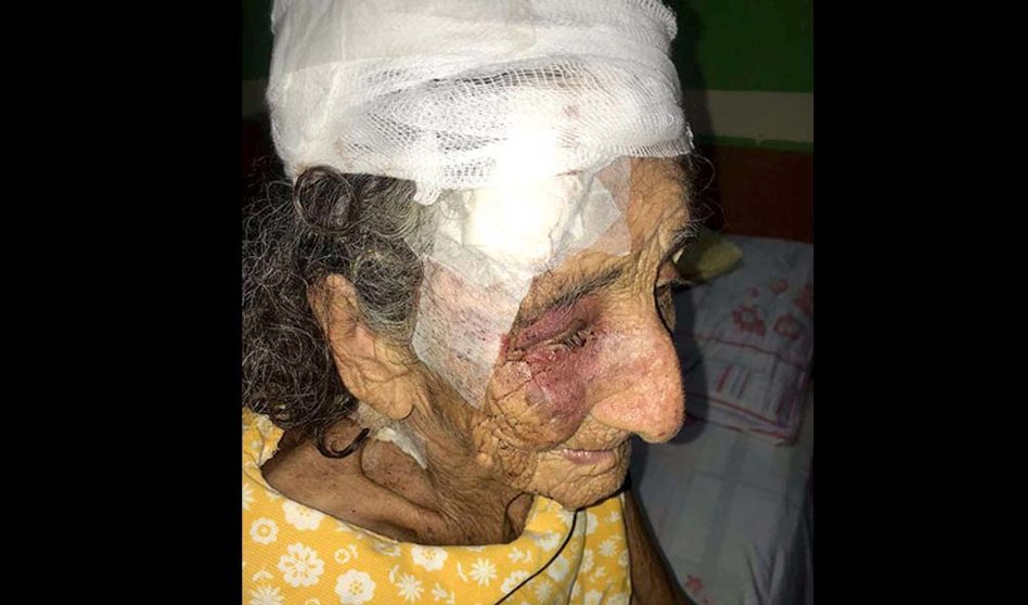 Anciana en Sonsonate es atacada por un pitbull 3