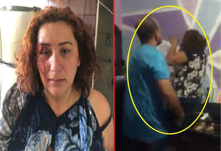 Mujer golpeada en Mejicanos