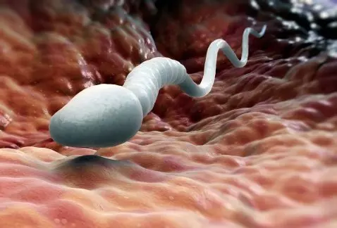 espermatozoide