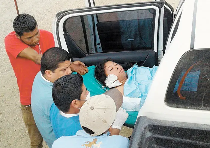 La joven Vilma Trujillo Garcia al momento que fue llevada de Rosita a Bonanza para tomar el avión que la llevo a Managua para recibir atención especializada. LAPRENSA/COTRESIA H.JARQUIN.