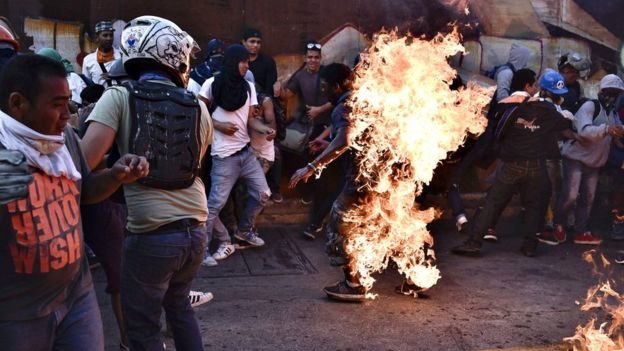 Joven quemado en protestas en Venezuela