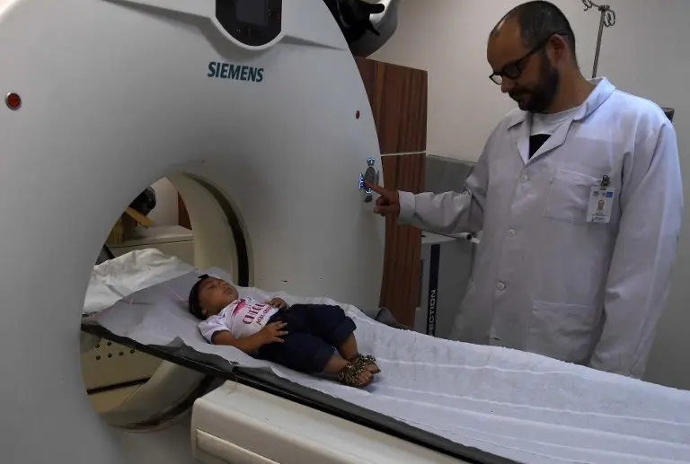 Four-month-old baby Maria Fernanda is examined at the State Brain Institute (IEC) in Rio de Janeiro, Brazil on January 2, 2017. 
Maria Fernanda's mother Brenda was infected with the zika virus, transmitted by the Aedes aegypti mosquito, while pregnant and her daughter was born with microcephaly, during a 2015-2016 wave of babies born with that condition, which involves a smaller-than-normal head size. / AFP PHOTO / VANDERLEI ALMEIDA