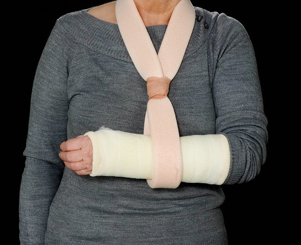 fractura en la mano
