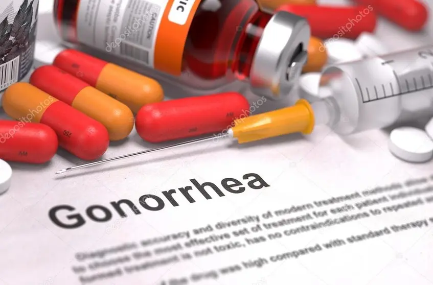 Gonorrea