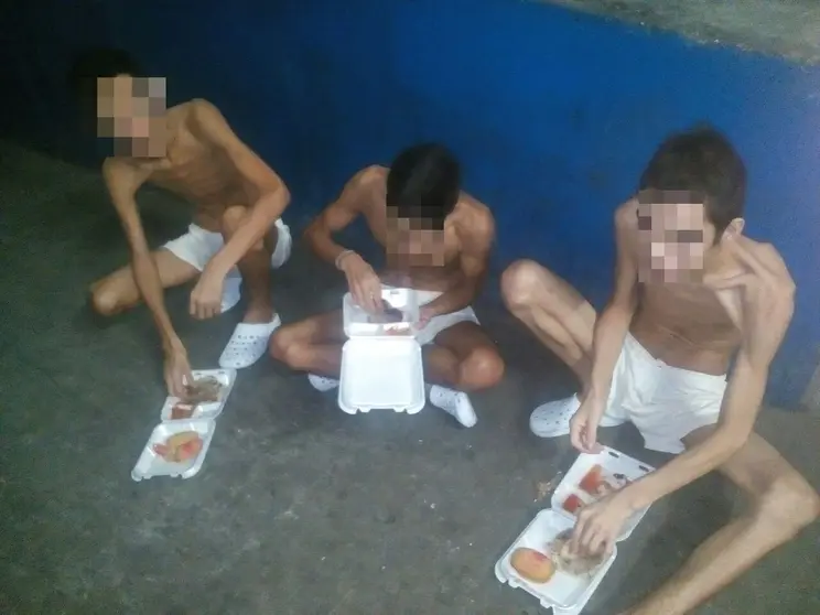 desnutrición