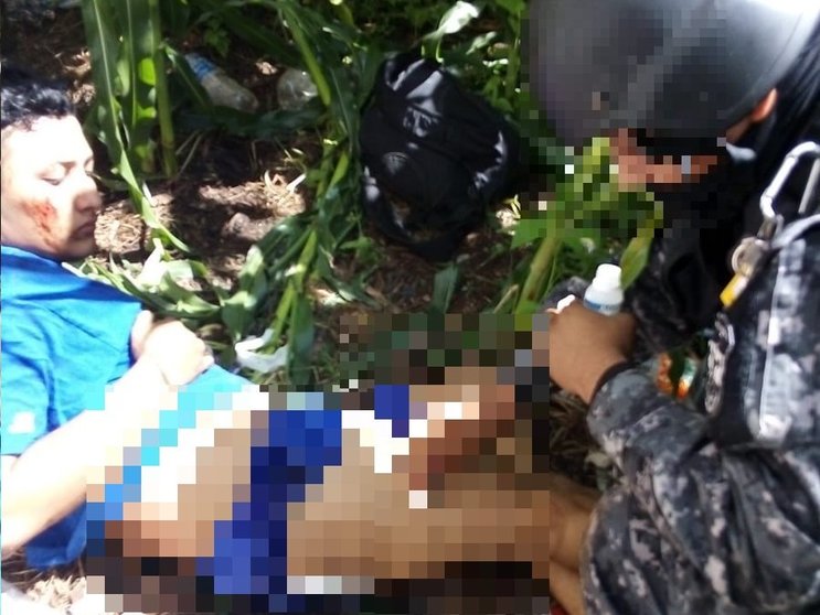 Pandillero herido en Ahuachapán