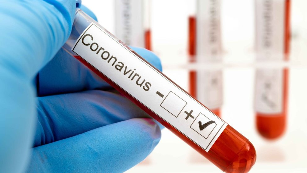 main-coronavirus-caso-positivo-generica-shutterstock_1654957318