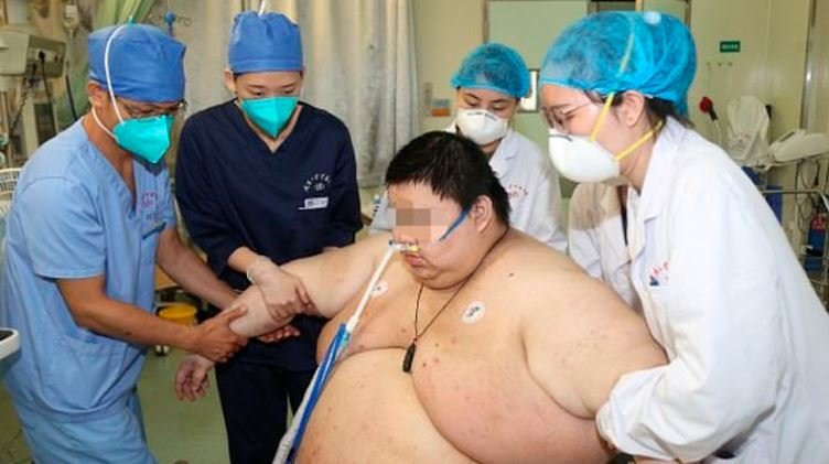 Gordo en China