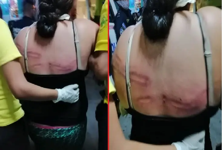 Mujer de 29 años vapuleada