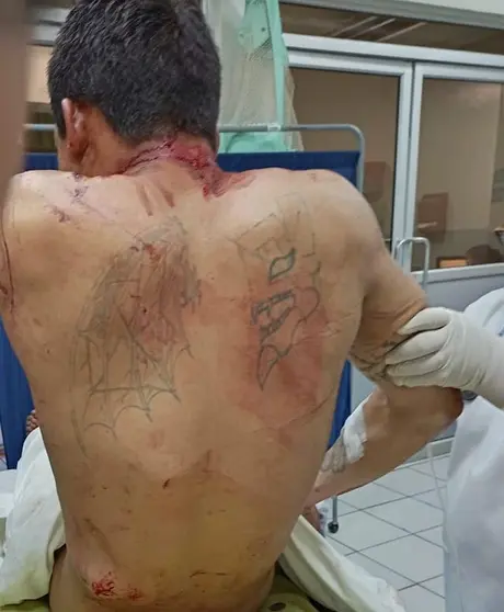 pandillero herido por sus compañeros