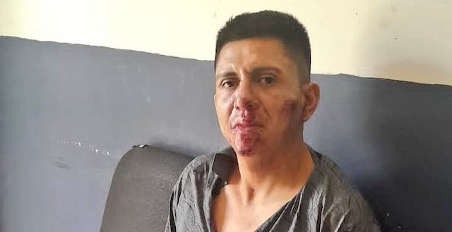 Manuel Antonio Calderón Avilés atropelló a dos personas mientras conducía en estado de ebriedad en la Troncal del Norte