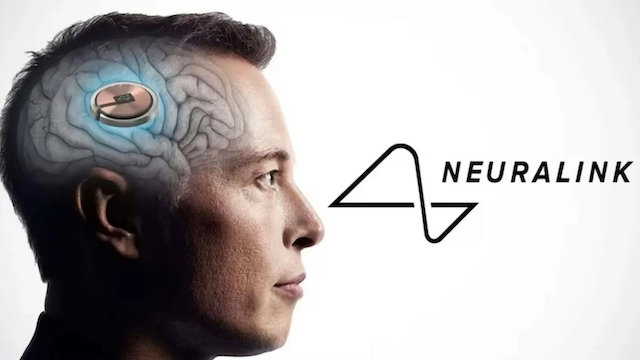 Neuralink Elon Musk copia