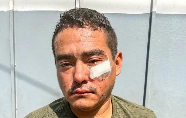 José Antonio Cañada Alas, intento de homicidio