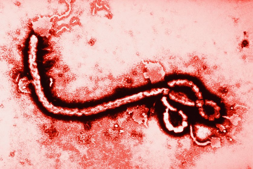 Virus ébola ampliado 108,000 veces