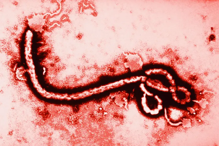 Virus ébola ampliado 108,000 veces