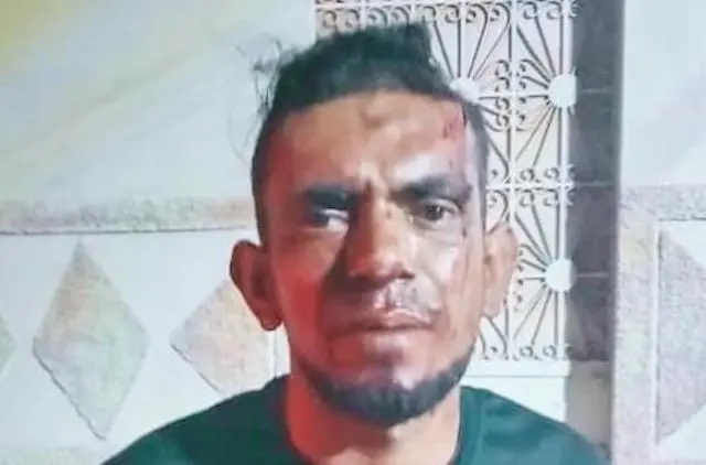 Edelmer José Pastora Rivera, lesiones o intento de homicidio 2