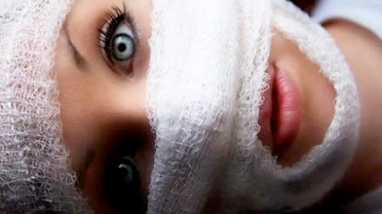 Cirug&iacute;a est&eacute;tica en adolescentes