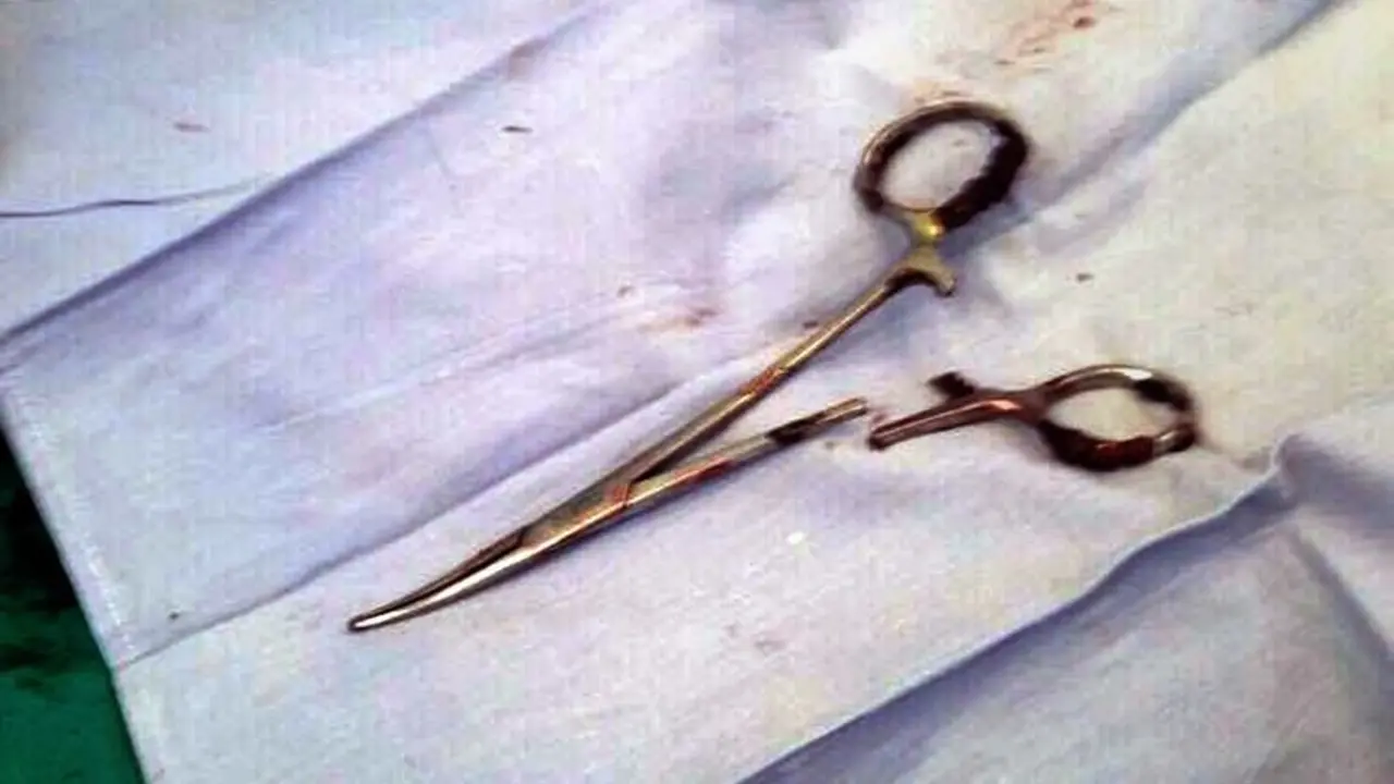 Tijeras en est&oacute;mago